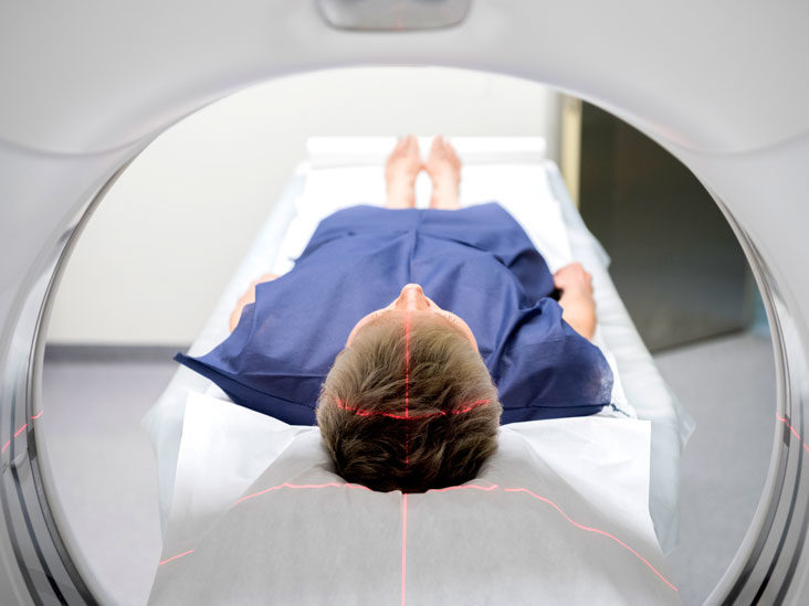 CT Scan